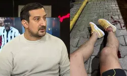 Serhat Akın Silahlı Saldırıya mı Uğradı? Serhat Akın'a Kim Neden Saldırdı?