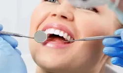 Yirmilik Dişler Gülüşünüzü Bozabilir! Uzmandan Kritik Uyarı