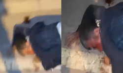 Darp Edip Bıçakladı, Yetmedi Videosunu Çekti