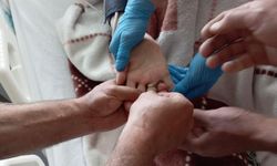 Kahramanmaraş'ta yaşlı kadının sıkışan yüzüğü kesilerek çıkarıldı