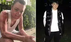 Kağıthane’de kuafördeki yangında tüm vücudu yanan 14 yaşındaki Engin'in tedavisi tamamlandı