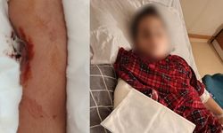 Akran zorbalığı, arkadaşının kolunu 2 yerden kırdı