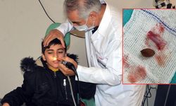 Kahramanmaraş’ta 11 Yaşındaki Çocuğun Burnundan Pipet ve Çekirdek Çıktı