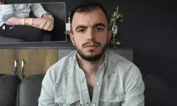 Başına metal parça saplanan işçi, 17,9 milyon TL tazminat kazandı