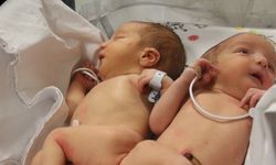 Depremden Sonra Yetim Kalan Siyam İkizlerinden Biri Hayatını Kaybetti