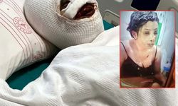 Eşinin başından aşağı kezzap döktüğü Sibel, olay anını anlattı