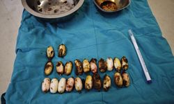 Midesinden 44 bonzai çıktı