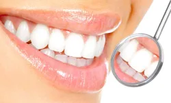 Uzmandan Diş Beyazlatma Uyarısı: Doğru Bilinen 7 Yanlış