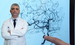 Beyin anevrizmasında ölüm riski yüzde 50’ye çıkabiliyor