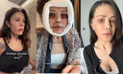 Didem Ceran yüz nakli mi oldu, son hali nasıl?