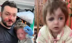 İkra ile babasının darbedilmesine ilişkin iddianame hazırlandı; çocuk skuter'ı 'silah' olarak sayıldı