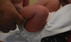Sünnet edilen 27 günlük bebek hayatını kaybetti