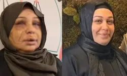 Ankara'da eşini yaralayan polis memurunun dosyası, ağır cezaya gönderildi