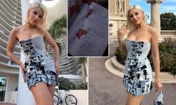 Arkadaşı otopsi raporunu paylaştı