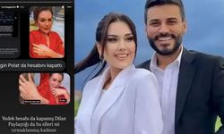 Dilan Polat’ın Ellerine Ne Oldu, Çizikler Ne Anlama Geliyor?