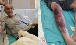 Herkesin başına gelebilir! Tıkalı lavaboyu açmak isterken yandı