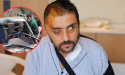 Kahramanmaraş’ta başına kaya düşen sürücü ameliyatla hayata döndü