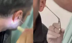 Kulağına gizlediği yasaklı madde ile yakalandı