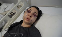 Oğlunun gözü önünde anneyi öldüresiye dövdüler: Yüzü tanınmaz halde