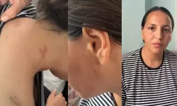 17 bıçak darbesiyle yaralanan Havva, tutuklanan eşinin en ağır cezayı almasını istedi