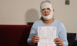 'Prenses' paketini seçti, yüzü yandı: Çocuğum beni gördü, 'öcü' diyerek kaçtı