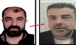 Cin*yete azmettirmekten aranan şüpheli, ameliyatla yüzünü değiştirmiş