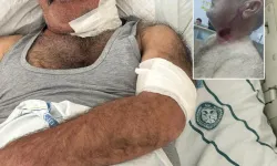 Severek beslediği atı boğazından ısırdı