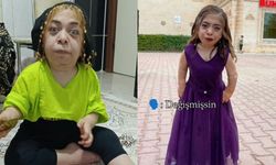 Tiktok Fenomeni Medine Sayan Kimdir, Ne Oldu, Sağlık Durumu Nasıl?