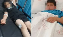 9 Yaşındaki Çocuk Parkta Oyun Oynarken Bacağından Vuruldu