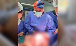 Karnındaki devasa şişlik 22 kiloluk tümör çıktı