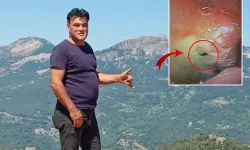Doktorlar Bile Şaşırdı! Midesinden Canlı Böcek Çıktı