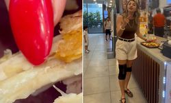 Fast Food Skandalı! Tavuk Menüsünden Kurt Çıktı