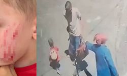 Sokakta oynayan çocuğa saldırı: O anlar kamerada