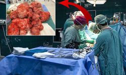55 Kiloluk Kadının Rahminden 17 Kiloluk Dev Miyom Çıkarıldı! Doktorlar Bile Şaşkına Döndü