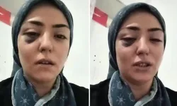 Şiddet gördüğünü öne süren kadın sosyal medyadan destek istedi