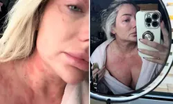 Barda tanıştığı siyahi bir adamla ilişkiye giren kadın hayatının şokunu yaşadı