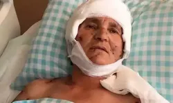 Köpek saldırısı mahkemeye taşındı! Yargıtay 637 bin TL tazminatı onadı