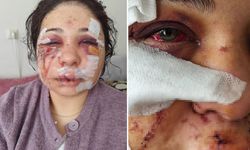 Eşini döven polis tahliye edildi, kadın da hapis cezası aldı