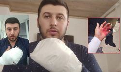 Sipariş tartışmasında motokurye döner bıçağıyla yaralandı!