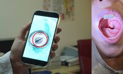 10 yaşındaki çocuğun boğazından canlı sülük çıktı