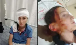 11 yaşındaki çocuğa köpek saldırısında 1,2 milyon TL tazminat kararı