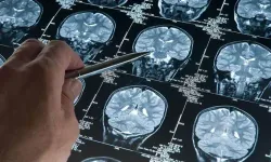 Bilim insanlarından Alzheimer için umut veren keşif: Derin uyku detayı
