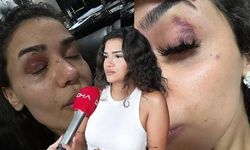 Uzaklaştırma kararına rağmen evinin önünde darbedilen Ebru: Ölmeden önce sesimi duyun