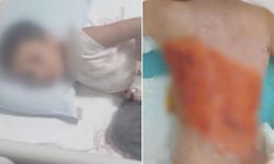 12 yaşındaki çocuğu diri diri yaktılar! Sonrası daha da korkunç