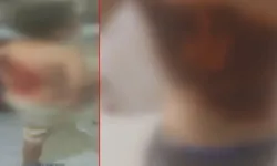 12 yaşındaki Batuhan'ın sırtına kolonya döküp yaktılar