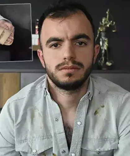 Başına metal parça saplanan işçi, 17,9 milyon TL tazminat kazandı