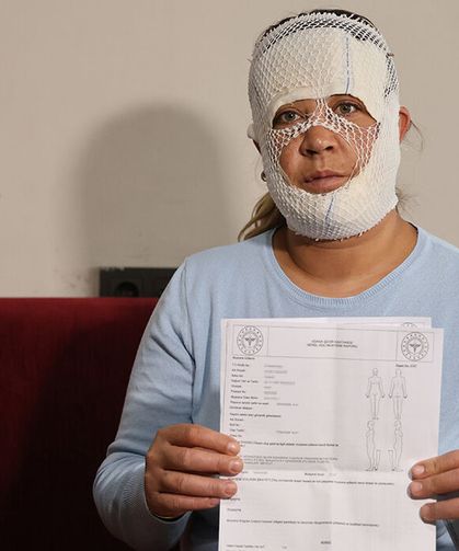 'Prenses' paketini seçti, yüzü yandı: Çocuğum beni gördü, 'öcü' diyerek kaçtı