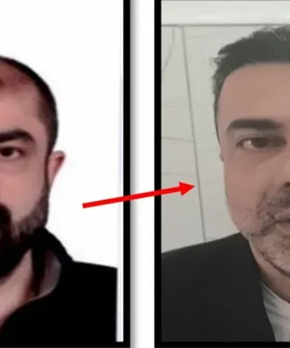 Cin*yete azmettirmekten aranan şüpheli, ameliyatla yüzünü değiştirmiş