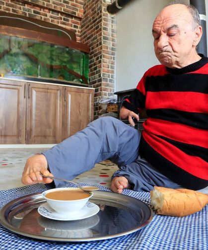 Doğuştan Eller Olmayan Mehmet Amca’nın Hayat Hikayesi Ağlattı