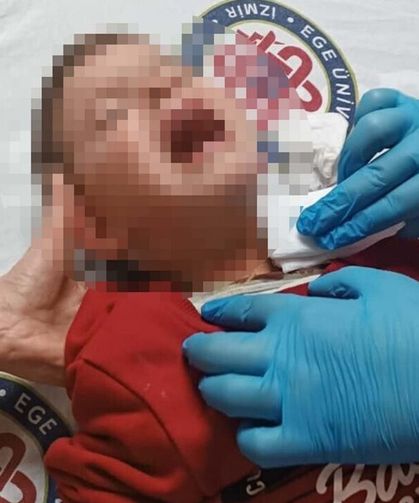 İzmir Karabağlar’da parkta saldırı! 2 yaşındaki çocuk bıçaklandı